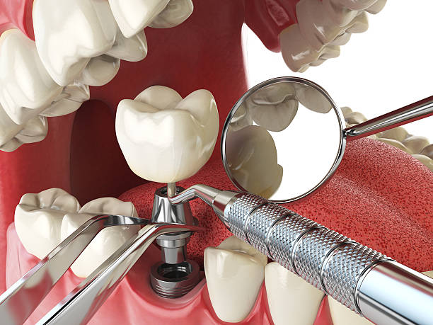 Best Emergency TMJ Treatment in Poplarville, MS
