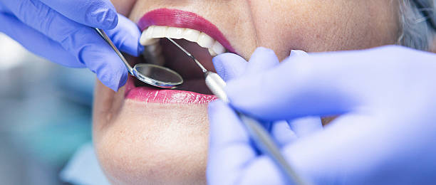 Best Emergency Treatment for Dental Infections or Abscesses in Poplarville, MS